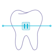 orthodontics_1 orthodontics_1