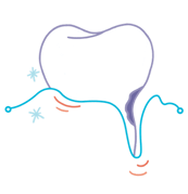 periodontics_10